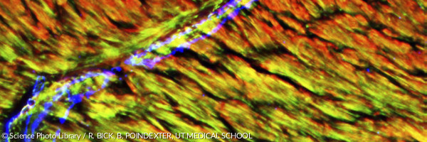 Heart arteriole,fluorescence micrograph