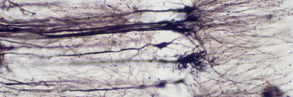 Nervenzellen unterm Mikroskop