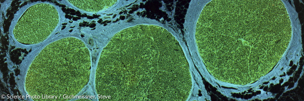 Nerve fibres, LM
